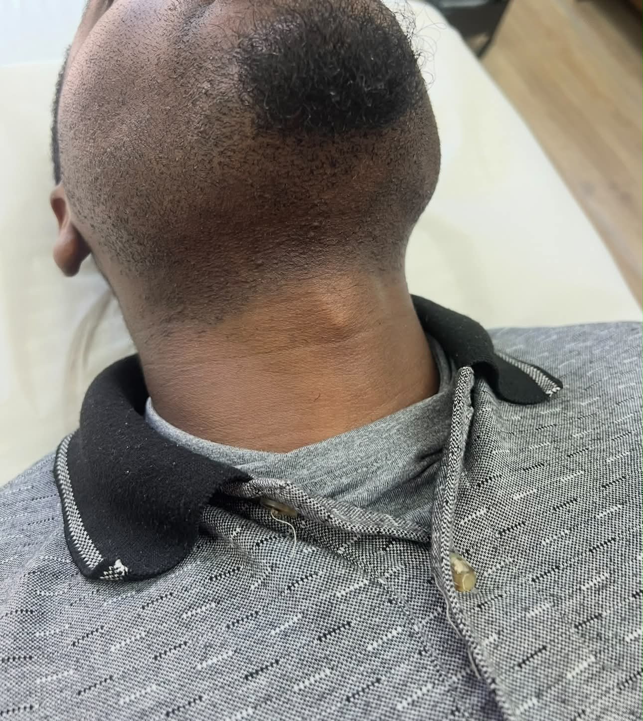 After photograph provided by Keter Spa, back of neck